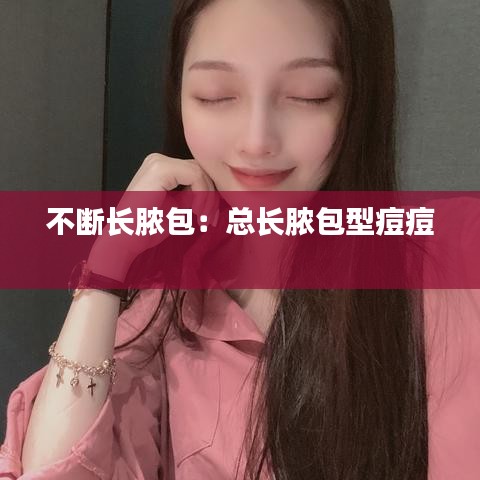 不斷長膿包：總長膿包型痘痘 